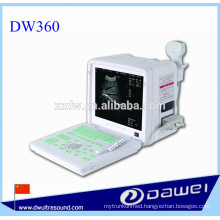 medical equipment ultrasound machine&portable ultrasound monitor DW360